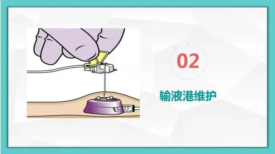 输液港居家护理全指南：守护“隐形生命线”，这些细节至关重要！