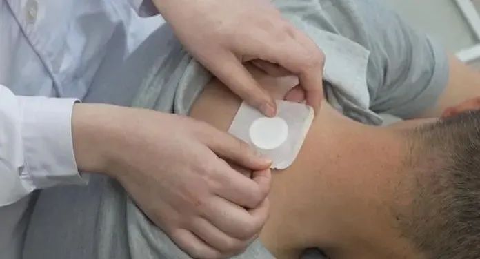 穴位贴敷：千年古法焕新颜，绿色无痛有妙招
